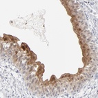 Anti-POF1B Antibody