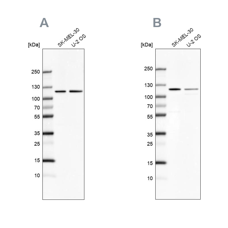 Anti-LONP1 Antibody
