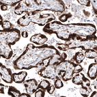 Anti-IGF2BP3 Antibody