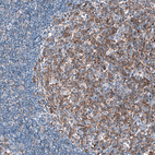 Immunohistochemical staining of humantonsil shows moderate cytoplasmic positivity in germinal center cells.