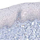 Immunohistochemical staining of human cervix shows no positivity in squamous epithelial cells as expected.