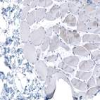 Immunohistochemical staining of human skeletal muscle shows no positivity in myocytes as expected.