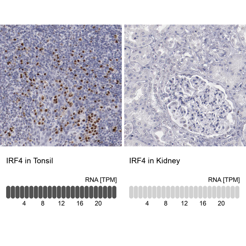 Anti-IRF4 Antibody
