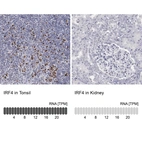 Anti-IRF4 Antibody