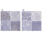 Anti-IRF4 Antibody