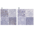 Immunohistochemical staining of human duodenum, kidney, pancreas and tonsil using Anti-IRF4 antibody HPA002038 (A) shows similar protein distribution across tissues to independent antibody HPA002698 (B).