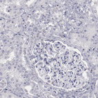 Immunohistochemical staining of human kidney shows no positivity in cells in tubules as expected.