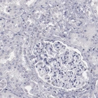 Immunohistochemical staining of human kidney shows no positivity in cells in tubules as expected.