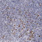 Immunohistochemical staining of human tonsil shows strong nuclear positivity in non-germinal center cells.