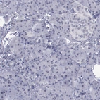 Immunohistochemical staining of human pancreas shows no positivity in exocrine glandular cells as expected.