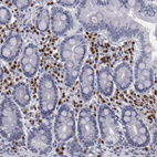 Immunohistochemical staining of human duodenum shows strong nuclear positivity in lymphoid cells.