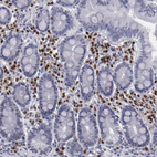 Anti-IRF4 Antibody