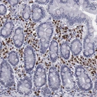 Immunohistochemical staining of human duodenum shows strong nuclear positivity in lymphoid cells.