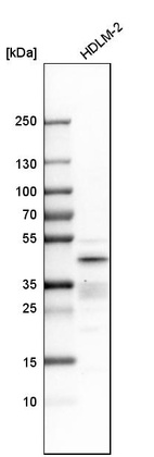 Western blot analysis in human cell line HDLM-2.