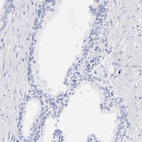 Immunohistochemical staining of human prostate shows low expression as expected.
