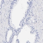 Immunohistochemical staining of human prostate shows low expression as expected.