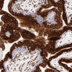 Anti-C1QTNF6 Antibody