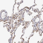 Immunohistochemical staining of human lung shows moderate nuclear and cytoplasmic positivity in pneumocytes.
