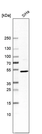 Western blot analysis in human cell line SiHa.