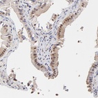 Anti-PSMC4 Antibody