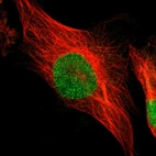 Immunofluorescent staining of human cell line U-251 MG shows localization to nucleoplasm.
