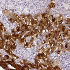 Immunohistochemical staining of human adrenal gland shows strong cytoplasmic positivity in glandular cells.