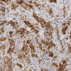 Anti-ARHGAP36 Antibody