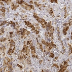 Immunohistochemical staining of human pituitary gland shows strong cytoplasmic positivity in cells in anterior lobe.