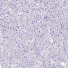 Immunohistochemical staining of human pancreas shows no positivity in exocrine glandular cells as expected.
