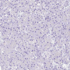 Anti-ARHGAP36 Antibody