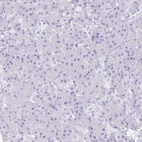 Immunohistochemical staining of human pancreas shows no positivity in exocrine glandular cells as expected.