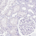 Immunohistochemical staining of human kidney shows no positivity in cells in tubules as expected.