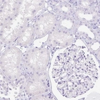 Immunohistochemical staining of human kidney shows no positivity in cells in tubules as expected.