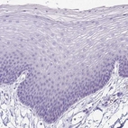 Immunohistochemical staining of human skin shows no positivity in squamous epithelial cells as expected.