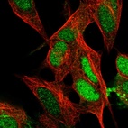 Immunofluorescent staining of human cell line SH-SY5Y shows localization to nucleus & plasma membrane.