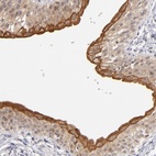 Anti-PCNX4 Antibody