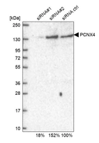 Western blot analysis in U2OS cells transfected with control siRNA, target specific siRNA probe #1 and #2, using Anti-PCNXL4 antibody. Remaining relative intensity is presented.