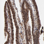 Immunohistochemical staining of human fallopian tube shows strong nuclear and cytoplasmic positivity in glandular cells.