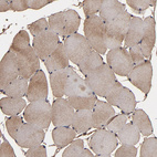 Immunohistochemical staining of human skeletal muscle shows moderate cytoplasmic positivity in myocytes.