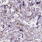 Immunohistochemical staining of human placenta shows strong positivity in endothelial cells.