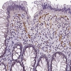 Immunohistochemical staining of human rectum shows strong positivity in endothelial cells.