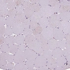 Immunohistochemical staining of human skeletal muscle shows no positivity in myocytes as expected.