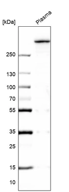 Western blot analysis in human plasma.
