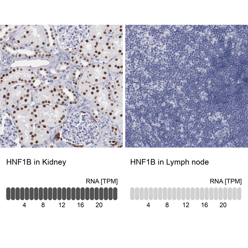 Anti-HNF1B Antibody