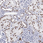 Immunohistochemical staining of human kidney shows moderate to strong nuclear positivity in renal tubules.