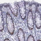 Immunohistochemical staining of human rectum shows strong nuclear positivity in glandular cells.