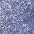 Immunohistochemical staining of human lymph node shows no positivity in lymphoid cells as expected.