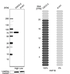 Western blot analysis in human cell lines Caco-2 and A-431 using Anti-HNF1B antibody. Corresponding HNF1B RNA-seq data are presented for the same cell lines. Loading control: Anti-PARP1.