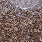 Immunohistochemical staining of human lymph node shows moderate to strong nuclear positivity in non - germinal center cells.