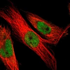 Immunofluorescent staining of human cell line U-251 MG shows localization to nucleoplasm & cytosol.